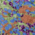 張金堅：粒線體：人體細胞發電站與癌症的進展息息相關