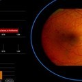 AI前進印度眼科醫院第一線，Google用深度學習及早發現7千萬糖尿病患的失明危機
