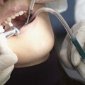 侵犯牙周組織，導致牙周病，牙醫師公開治療3階段，目的在於延長牙齒壽命
