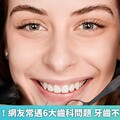 牙齒不健康！網友常遇6大齒科問題 牙齒不整齊最惱人