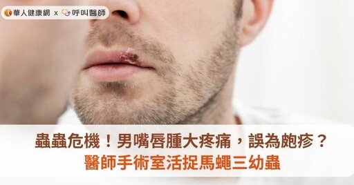 蟲蟲危機！男嘴唇腫大疼痛，誤為皰疹？醫師手術室活捉馬蠅三幼蟲