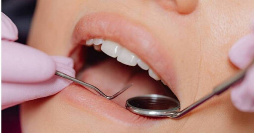 牙結石多久清一次？ 醫師曝「兩大關鍵」決定洗牙週期