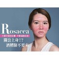 關公上身！？酒糟臉不要來只要可愛的紅暈 不要滿臉紅斑