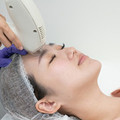對抗皺紋新選擇：「TMA熱力點陣皮膚治療系統」