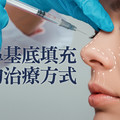 綜觀鼻基底填充的治療方式