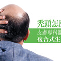 禿頭怎麼救？皮膚專科醫師分享複合式生髮療程
