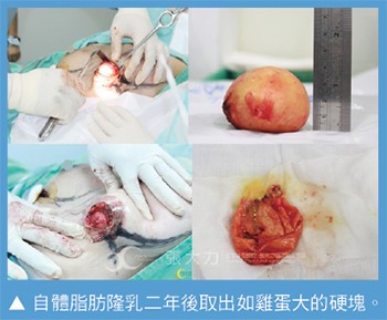 國際整形外科盛會 台灣整外權威張大力醫師受邀演講