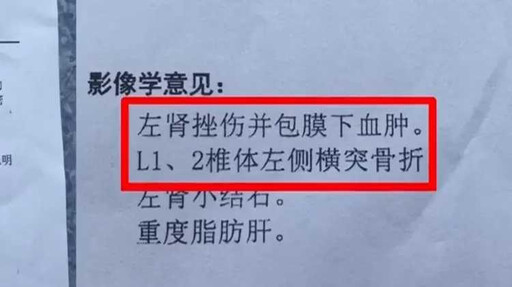 男子路邊吃東西被樹葉砸到骨折 網一看「凶器照」驚呼：嚴重會死人