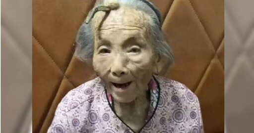 107歲老人額頭長角！網驚呼「是長壽角」 醫揭真相：疾病表現