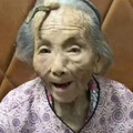 107歲老人額頭長角！網驚呼「是長壽角」 醫揭真相：疾病表現