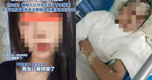 被前男友折磨30小時！妹子慘遭「潑熱水毀容」 他以為人死了才去自首