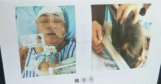 真的被嚇死…甘肅女目睹媽車禍「撞成重傷癱瘓」 5天後離奇猝死