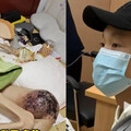 以為成長痛！檢查竟是「骨肉瘤」 陸18歲網紅抗癌3年病逝