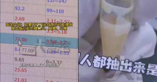 三酸甘油酯超標45倍!連吃4個月火鍋 31歲女子體內竟抽出「奶油血」