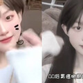 中國「抗癌網紅」千千胃癌離世！ 生前曾曝：不規律吃飯、愛吃辣