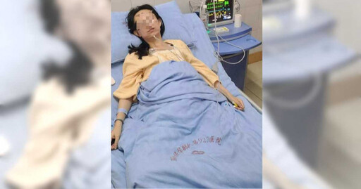 她住酒店竟遭毒蛇咬!女狂打16支血清搶命2年還頭暈臉麻 業者僅賠5萬