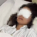 景區玩漂流遇襲！陌生男持高壓水槍狂噴 妹子「眼球打成血水」慘失明