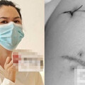 妙齡女逛街遭陌生人挾持「狂捅22刀」 靠隆乳假體撿回一命