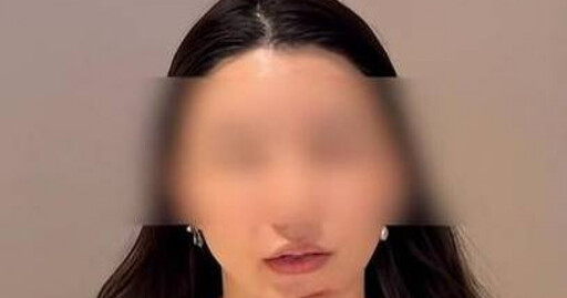 南京女臉部脂肪填充失敗 修復手術險毀容「留6公分疤痕」