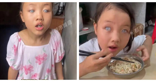 女童2歲突因基因突變失明 母淚訴：她問什麼時候能看到這個世界