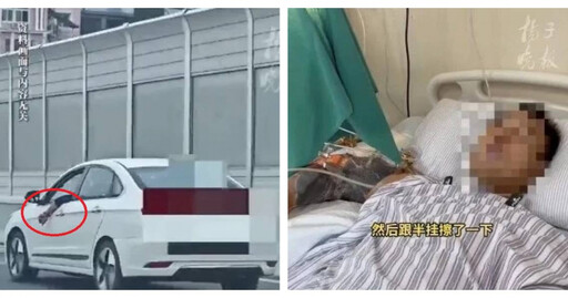 手伸窗外一秒變悲劇！男子手臂遭貨車夾斷3截 醫師4小時救回