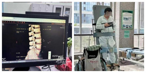 剛做完一個動作就癱瘓!男子參加衝浪課動作失誤 釀成罕見「衝浪脊髓症」奪行動力