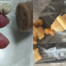 蛋糕、香腸、燒賣都吃出牙齒！ 網嚇壞：就怕是真牙