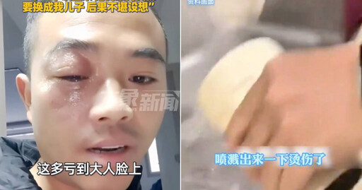 保溫杯倒入「剛燒開熱水」打開噴出 男子灼傷眼部險釀意外