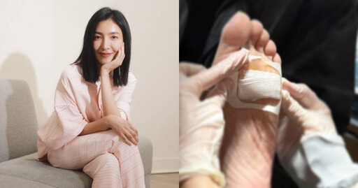 楊謹華收工返家「被木屑直插腳底」！冒汗掛急診現況曝光