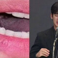 「金秀賢舌頭」衝微博熱搜！陸網驚呼：是菜花？ 專業醫生給答案