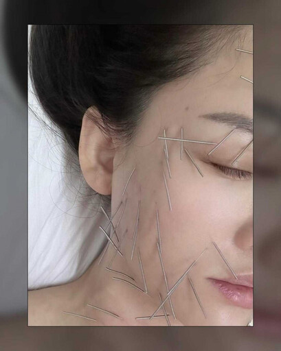 陳喬恩「全身扎百針」刺滿臉 驚悚畫面曝光:我是不會招的