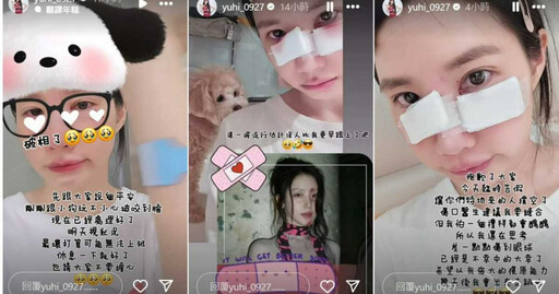 樂天女孩筠熹遭愛犬咬傷臉部 傷勢照曝光!她急向球迷告假