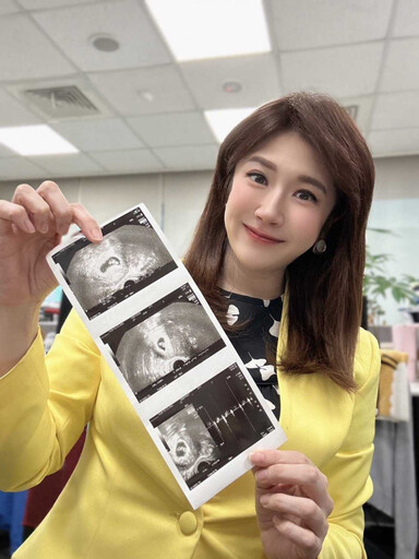 好孕藏不住1/主播鄭亦真甜牽老公夜奔婦產科 「肚皮隆起」洩孕味