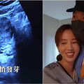愛雅宣布懷孕！開心喊：她毫無預警地闖進我的生命