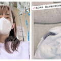 林舒語突發腹痛「肚子脹成球」掛急診 醫揭腹腔積血不排除開刀