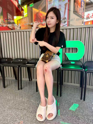 蔡尚樺出意外「路邊仆街」!下巴著地手腳濺血 痛喊:水逆擋災解厄
