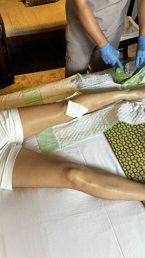 公關女強人峇里島驚傳意外！「踩空膝蓋卡石縫」險脫困 皮都被磨掉