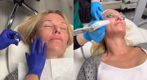 悚！美國52歲女星臉部嚴重毀容 「像融化一樣」嘆：我真是太痛苦了