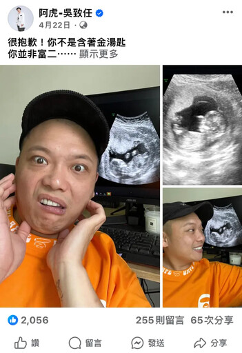 4月才宣布當爸！阿虎老婆腹中胎兒突沒心跳