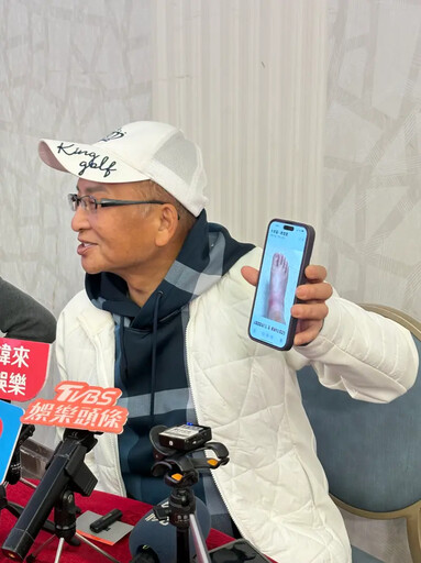 露面吐最新近況 66歲孔鏘生怪病只怕要截肢