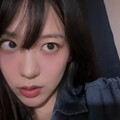 韓28歲女星「罹患血癌」！自嘲：運氣爛透了
