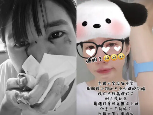 遭酸民質疑不忍反擊 筠熹破相忍淚取消應援