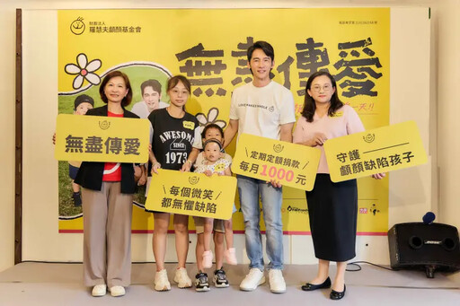 腭裂女孩堅強活過4年 温昇豪化身愛心大使