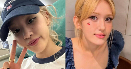 長痘痘怎麼辦？快學Rosé、SOMI全昭彌貼上無敵可愛痘痘貼，這造型還以為是臉上的小裝飾呢！