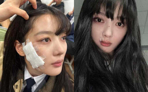 戲裡是「反社會惡女」，戲外是「自律女神」！金裕貞《親愛的X》美貌封神，4大凍齡秘訣揭秘