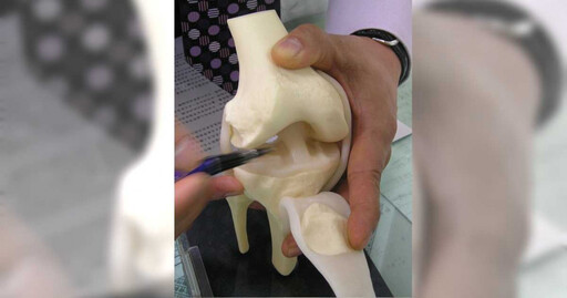 是它惹禍1／保戶聽醫生花近4萬半月板軟骨癒合粉劑 薰衣草實支實付拒賠