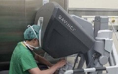 跨腔室消化道微創手術跨越限制 新竹臺大分院以達文西手臂輔助