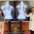 僑生脊椎像蜈蚣 台灣醫生神救援