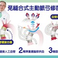 主動脈剝離免縫合 台中慈濟醫院成功率百分百
