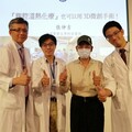 大腸癌腹膜轉移 微創3D手術加腹腔溫熱化療 抗癌更順利